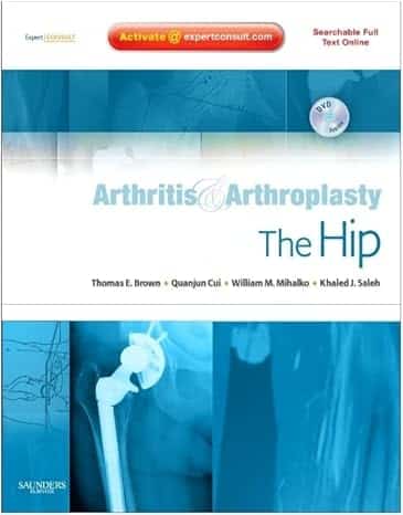 Arthritis and Arthroplasty: The Hip : Expert Consult - Online, Print and DVD