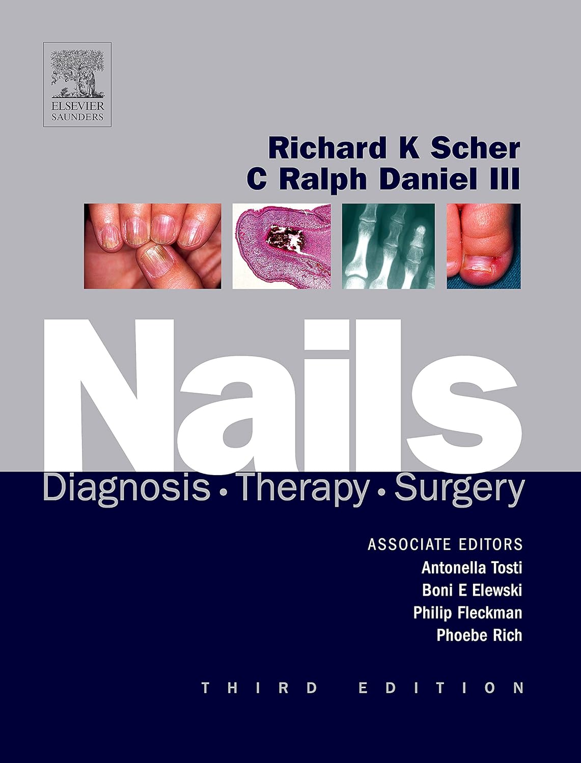 Nails : Diagnosis, Therapy, Surgery