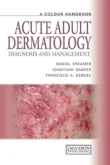Acute Adult Dermatology: Diagnosis and Management: A Colour Handbook